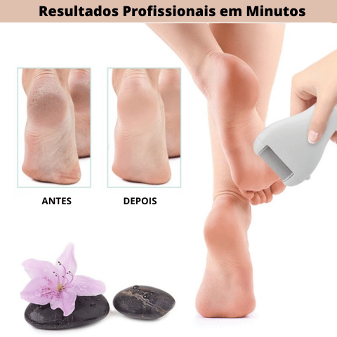 Lixa Elétrica para os Pés Profissional